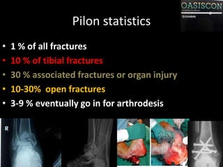 Open Pilon Pilon fractures reduction and fixation technics-dr mohamed ashraf-govt ...