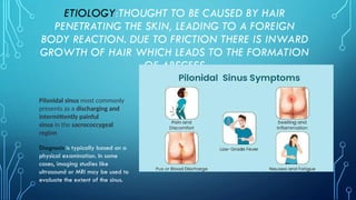 ETIOLOGY:THOUGHT TO BE CAUSED BY HAIR
PENETRATING THE SKIN, LEADING TO A FOREIGN
BODY REACTION. DUE TO FRICTION THERE IS INWARD
GROWTH OF HAIR WHICH LEADS TO THE FORMATION
OF ABSCESS
AND SINUS
Pilonidal sinus most commonly
presents as a discharging and
intermittently painful
sinus in the sacrococcygeal
region
Diagnosis is typically based on a
physical examination. In some
cases, imaging studies like
ultrasound or MRI may be used to
evaluate the extent of the sinus.
 