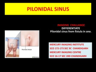 PILONIDAL SINUS IMAGING  CHALLANGE                                       DIFFERENTIATE                                     Pilonidal sinus from fistula in ano.  MERCURY IMAGING INSTITUTE  SCO 172-173 SEC 9C  CHANDIGARH MERCURY IMAGING CENTRE  SCO 16-17 SEC 20D CHANDIGARH 