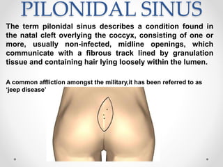 PILONIDAL SINUS
The term pilonidal sinus describes a condition found in
the natal cleft overlying the coccyx, consisting of one or
more, usually non-infected, midline openings, which
communicate with a fibrous track lined by granulation
tissue and containing hair lying loosely within the lumen.
A common affliction amongst the military,it has been referred to as
‘jeep disease’.
 