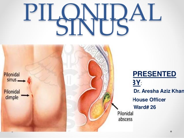 Surgical Excision (Shave Excision of Skin Lesion)