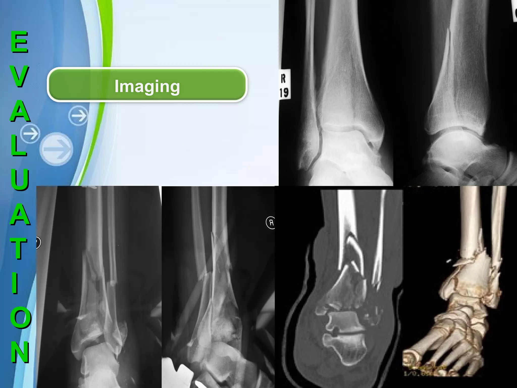 E
V
A
L
U
A
T
I
O
N

Imaging

Powerpoint Templates

Page 11

 