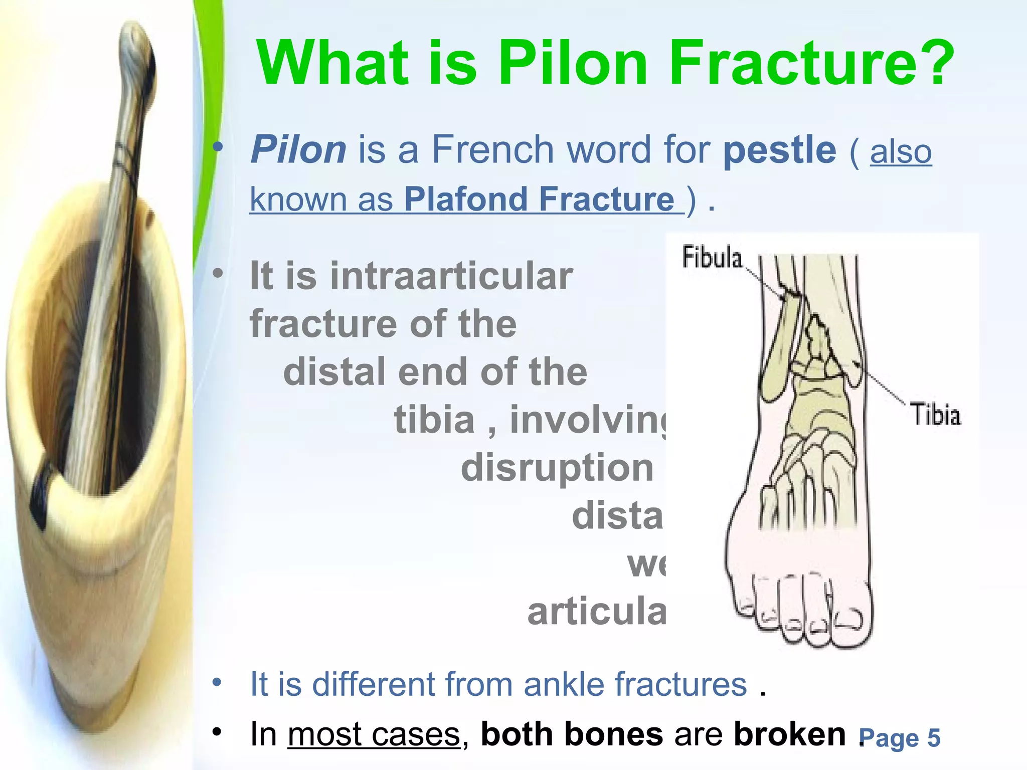 What is Pilon Fracture?
• Pilon is a French word for pestle ( also
known as Plafond Fracture ) .
• It is intraarticular
fracture of the
distal end of the
tibia , involving the
disruption of the
distal tibial
weight-bearing
articular surface .
• It is different from ankle fractures .
Powerpoint Templates
• In most cases, both bones are broken .
Page 5

 
