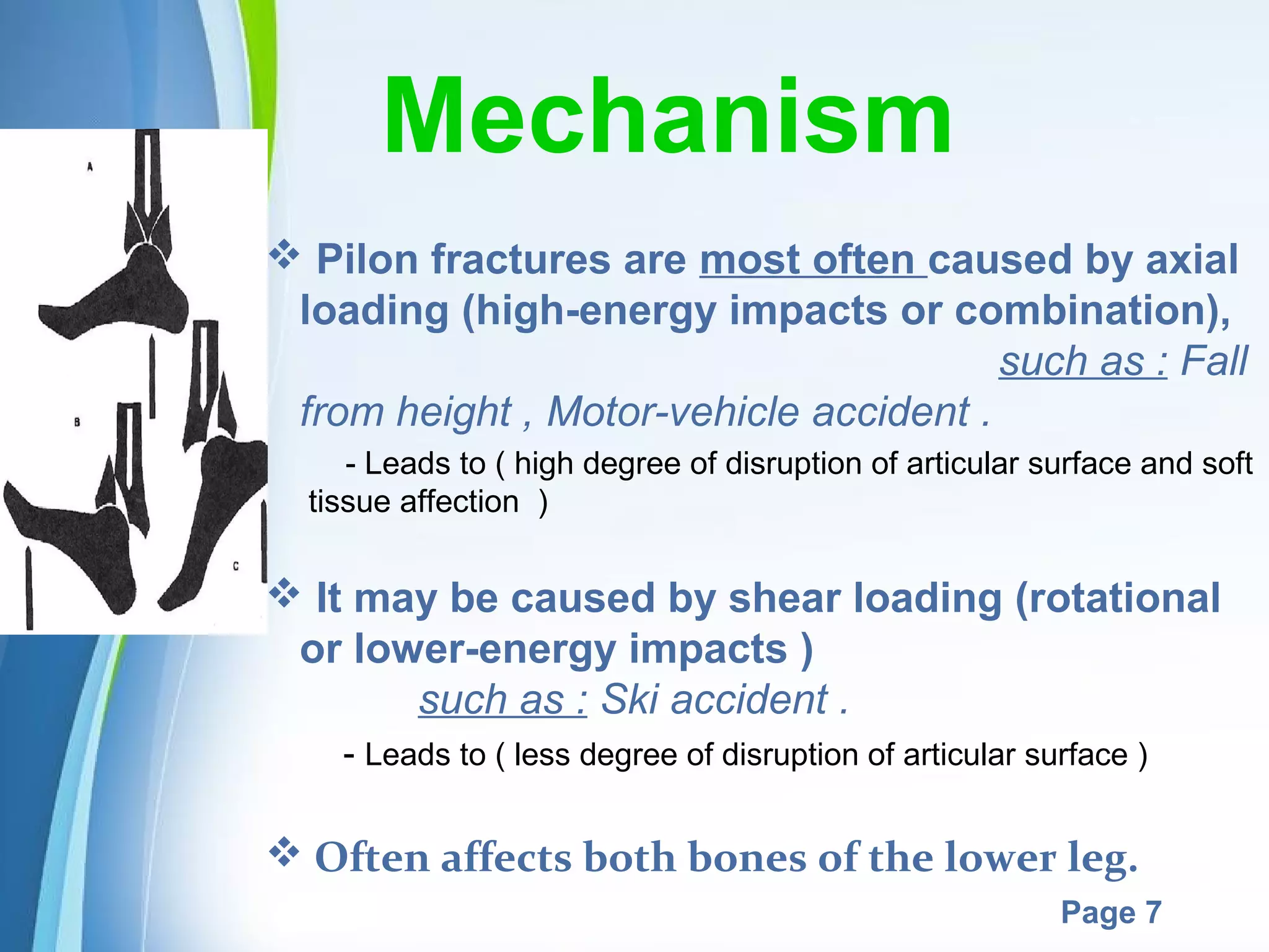 Mechanism
 Pilon fractures are most often caused by axial
loading (high-energy impacts or combination),
such as : Fall
from height , Motor-vehicle accident .
- Leads to ( high degree of disruption of articular surface and soft
tissue affection )

 It may be caused by shear loading (rotational
or lower-energy impacts )
such as : Ski accident .
- Leads to ( less degree of disruption of articular surface )

 Often affects both bones of the lower leg.
Powerpoint Templates

Page 7

 