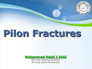 Pilon Fractures
Mohammed Nabil J AlAli
5th Year Medical Student
At King Faisal University

Powerpoint Templates

Page 1

 