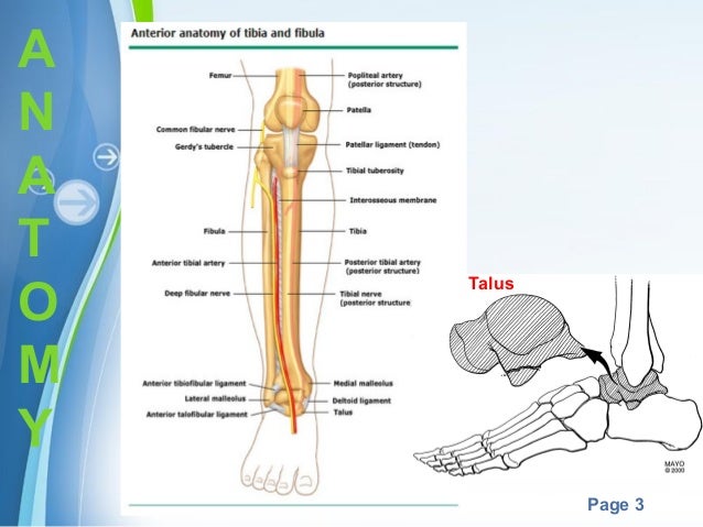 Pilon Fractures Or Plafond Pilon Fractures Or Plafond