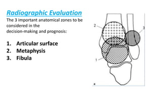 Radiographic Evaluation
The 3 important anatomical zones to be
considered in the
decision-making and prognosis:
1. Articular surface
2. Metaphysis
3. Fibula
 