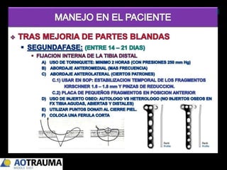 Pilon Definicion Pilon tibial | PPTX
