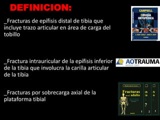 Pilon Definicion Pilon tibial | PPTX