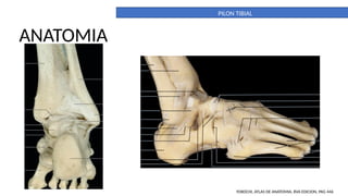 Pilon Definicion PILON TIBIAL. DEFINITIVO. importante para la anatomia | PPTX