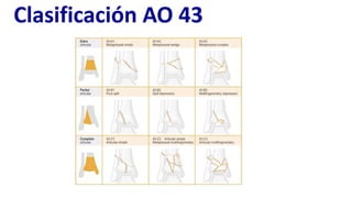Comprehensive Approach to Tibial Pilon Fracture Diagnosis and Treatment ...