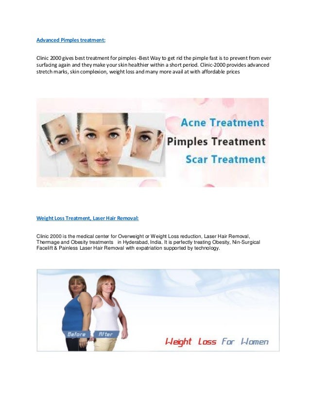 Does fluoxetine make you gain or loss weight picture 6