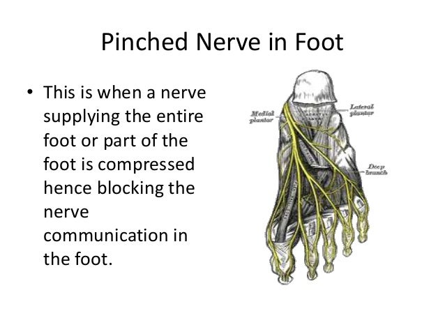 how to get rid of pinched nerve in foot