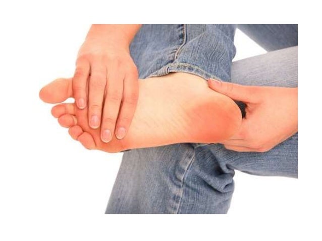 How to Get Rid of Pinched nerve in foot