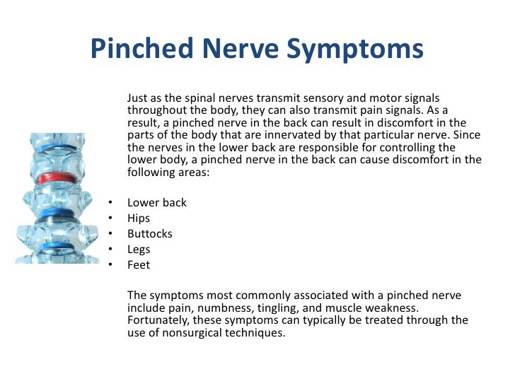 How do you treat a pinched nerve?