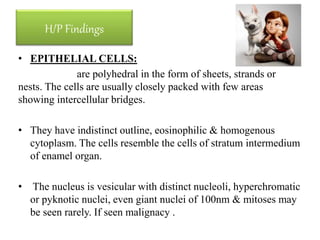 H/P Findings
• EPITHELIAL CELLS:
are polyhedral in the form of sheets, strands or
nests. The cells are usually closely packed with few areas
showing intercellular bridges.
• They have indistinct outline, eosinophilic & homogenous
cytoplasm. The cells resemble the cells of stratum intermedium
of enamel organ.
• The nucleus is vesicular with distinct nucleoli, hyperchromatic
or pyknotic nuclei, even giant nuclei of 100nm & mitoses may
be seen rarely. If seen malignacy .
 
