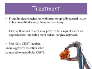 Treatment
• From Surgical enucleation with macroscopically normal tissue
to hemimandibulectomy /hemimaxillectomy.
• Clear cell variant of ceot may prove to be a sign of increased
aggresiveness indicating more radical surgical approach.
• Maxillary CEOT requires
more aggresive resection when
compared to mandibular CEOT.
 