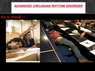 ADVANCED CIRCADIAN RHYTHM DISORDER
As a result:::::
 