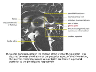 Diagnostic Imaging of Pineal Region Masses | PPT