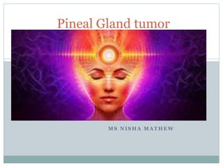 M S N I S H A M A T H E W
Pineal Gland tumor
 