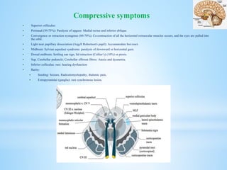 Superior colliculus:
 Perinaud (50-75%): Paralysis of upgaze: Medial rectus and inferior oblique.
 Convergence or retraction nystagmus (60-70%): Co-contraction of all the horizontal extraocular muscles occurs, and the eyes are pulled into
the orbit.
 Light near pupillary dissociation (Argyll Robertson's pupil): Accommodate but react.
 Midbrain: Sylvian aqueduct syndrome: paralysis of downward or horizontal gaze.
 Dorsal midbrain: Settling sun sign, lid retraction (Collier’s) (10%) or ptosis.
 Sup. Cerebellar peduncle: Cerebellar efferent fibres: Ataxia and dysmetria.
 Inferior colliculus: rare: hearing dysfunction
 Rarity:
 Seeding: Seizure, Radiculomyelopathy, thalamic pain,
 Extrapyramidal (ganglia): rare synchronous lesion.
Compressive symptoms
 