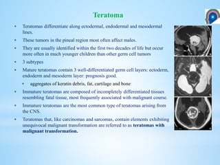  Teratomas differentiate along ectodermal, endodermal and mesodermal
lines.
 These tumors in the pineal region most often affect males.
 They are usually identified within the first two decades of life but occur
more often in much younger children than other germ cell tumors
 3 subtypes
 Mature teratomas contain 3 well-differentiated germ cell layers: ectoderm,
endoderm and mesoderm layer: prognosis good.
 aggregates of keratin debris, fat, cartilage and bone
 Immature teratomas are composed of incompletely differentiated tissues
resembling fatal tissue, most frequently associated with malignant course.
 Immature teratomas are the most common type of teratomas arising from
the CNS.
 Teratomas that, like carcinomas and sarcomas, contain elements exhibiting
unequivocal malignant transformation are referred to as teratomas with
malignant transformation.
Teratoma
 