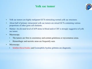 Yolk sac tumors are highly malignant GCTs mimicking normal yolk sac structures.
 About half of primary intracranial yolk sac tumors are mixed GCTs containing various
proportions of other germ cell elements.
 Marker: An elevated level of AFP alone in blood and/or CSF is strongly suggestive of yolk
sac tumor.
 Macroscopy
 The tumors are firm in consistency and contain gelatinous or myxomatous areas.
 Hemorrhagic and necrotic areas are frequently seen.
 Microscopy:
 Schiller-Duval bodies and Eosinophilic hyaline globules are diagnostic.
Yolk sac tumor
 