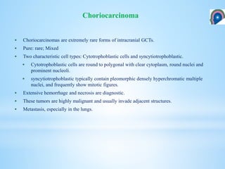  Choriocarcinomas are extremely rare forms of intracranial GCTs.
 Pure: rare; Mixed
 Two characteristic cell types: Cytotrophoblastic cells and syncytiotrophoblastic.
 Cytotrophoblastic cells are round to polygonal with clear cytoplasm, round nuclei and
prominent nucleoli.
 syncytiotrophoblastic typically contain pleomorphic densely hyperchromatic multiple
nuclei, and frequently show mitotic figures.
 Extensive hemorrhage and necrosis are diagnostic.
 These tumors are highly malignant and usually invade adjacent structures.
 Metastasis, especially in the lungs.
Choriocarcinoma
 