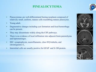  Pineocytomas are well-differentiated bening neoplasm composed of
relatively small, uniform, mature cells resembling mature pineocytes.
 Young adult.
 Degenerative changes including cyst formation and focal hemorrhage
can be present.
 They may disseminate widely along the CSF pathways.
 There is no evidence of local infiltration into adjacent brain parenchyma
and leptomeninges.
 IHC: synaptophysin, neurofilaments, class III β-tubulin, and
chromogranin A ,
 Interstitial cells are usually positive for GFAP and S-100 protein.
PINEALOCYTOMA
 