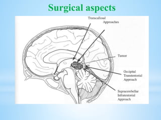 Surgical aspects
 