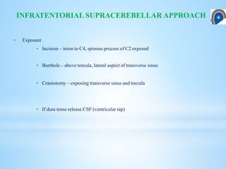 INFRATENTORIAL SUPRACEREBELLAR APPROACH
• Exposure
• Incision – inion to C4, spinous process of C2 exposed
• Burrhole – above torcula, lateral aspect of transverse sinus
• Craniotomy – exposing transverse sinus and torcula
• If dura tense release CSF (ventricular tap)
 