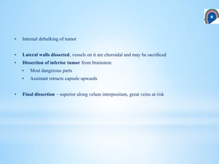  Internal debulking of tumor
 Lateral walls dissected, vessels on it are choroidal and may be sacriﬁced
 Dissection of inferior tumor from brainstem
 Most dangerous parts
 Assistant retracts capsule upwards
 Final dissection – superior along velum interpositum, great veins at risk
 