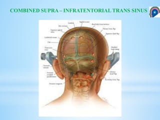 COMBINED SUPRA – INFRATENTORIAL TRANS SINUS
 