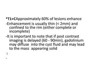 *T1+CApproximately 60% of lesions enhance
-Enhancement is usually thin (< 2mm) and
confined to the rim (either complete or
incomplete)
-It is important to note that if post contrast
imaging is delayed (60 - 90min), gadolinium
may diffuse into the cyst fluid and may lead
to the mass appearing solid
:
-
 