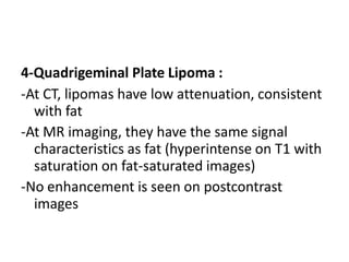 4-Quadrigeminal Plate Lipoma :
-At CT, lipomas have low attenuation, consistent
with fat
-At MR imaging, they have the same signal
characteristics as fat (hyperintense on T1 with
saturation on fat-saturated images)
-No enhancement is seen on postcontrast
images
 