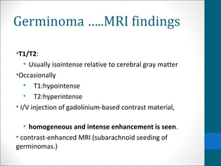 Germinoma …..MRI findings 
•T1/T2: 
• Usually isointense relative to cerebral gray matter 
•Occasionally 
• T1:hypointense 
• T2:hyperintense 
• I/V injection of gadolinium-based contrast material, 
• homogeneous and intense enhancement is seen. 
• contrast-enhanced MRI (subarachnoid seeding of 
germinomas.) 
 