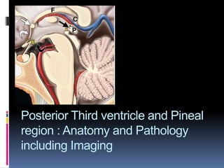 Posterior Third ventricle and Pineal
region : Anatomy and Pathology
including Imaging
 
