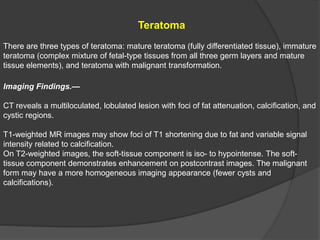 Teratoma
There are three types of teratoma: mature teratoma (fully differentiated tissue), immature
teratoma (complex mixture of fetal-type tissues from all three germ layers and mature
tissue elements), and teratoma with malignant transformation.
Imaging Findings.—
CT reveals a multiloculated, lobulated lesion with foci of fat attenuation, calcification, and
cystic regions.
T1-weighted MR images may show foci of T1 shortening due to fat and variable signal
intensity related to calcification.
On T2-weighted images, the soft-tissue component is iso- to hypointense. The soft-
tissue component demonstrates enhancement on postcontrast images. The malignant
form may have a more homogeneous imaging appearance (fewer cysts and
calcifications).
 