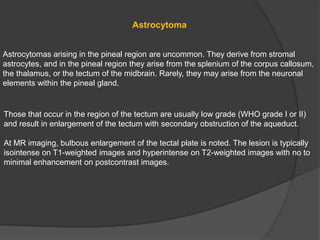 Astrocytoma
Astrocytomas arising in the pineal region are uncommon. They derive from stromal
astrocytes, and in the pineal region they arise from the splenium of the corpus callosum,
the thalamus, or the tectum of the midbrain. Rarely, they may arise from the neuronal
elements within the pineal gland.
Those that occur in the region of the tectum are usually low grade (WHO grade I or II)
and result in enlargement of the tectum with secondary obstruction of the aqueduct.
At MR imaging, bulbous enlargement of the tectal plate is noted. The lesion is typically
isointense on T1-weighted images and hyperintense on T2-weighted images with no to
minimal enhancement on postcontrast images.
 