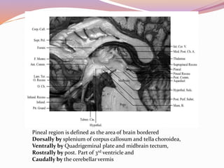 Pineal region tumors | PPTX