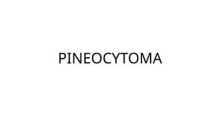 PINEAL REGION TUMORS.pptx radiation oncology | PPTX