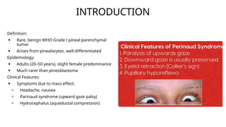 PINEAL REGION TUMORS.pptx radiation oncology | PPTX