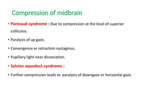 Compression of midbrain
• Parinaud syndrome : Due to compression at the level of superior
colliculus.
• Paralysis of up gaze,
• Convergence or retraction nystagmus,
• Pupillary light-near dissociation.
• Sylvian aqueduct syndrome :
• Further compression leads to paralysis of downgaze or horizontal gaze.
 