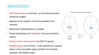 RADIOLOGY
• CSF dissemination is common, so the entire neuroaxis
should be imaged.
• Appears to be "draped“ around the posterior third
ventricle.
• Obstructive hydrocephalus is variable.
• Pineal calcifications are "engulfed“ and surrounded by
tumour.
• Strong uniform enhancement on CECT is typical.
• Multiple lesions are common : Look carefully for a second
lesion in the suprasellar region (anterior 3rd ventricle
recesses, infundibular stalk)
 