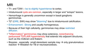 MRI
• T1- and T2WI :- Iso to slightly hyperintense to cortex.
• Intratumoural cysts are common, especially in larger and "ectopic" lesions.
• Hemorrhage is generally uncommon except in basal ganglionic
germinomas.
• T2* (GRE, SWI) may show "blooming" due to intratumoural calcification.
• Enhancement : Strong and usually homogeneous.
• Because of their high cellularity, germinomas may show restricted
diffusion.
• "Inflammatory" germinomas may show extensive, nonenhancing
peritumoral T2/FLAIR hyperintensity that extends into adjacent structures,
such as the midbrain and thalami.
• Biopsies , especially small stereotaxic sample may  only granulomatous
reaction  Mistaken for TB or neurosarcoidosis.
 