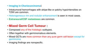 • Imaging in Choriocarcinoma:
• Intratumoral hemorrhages with stripe-like or patchy hypointensities on
T2WI are common.
• Heterogeneous rim and nodular enhancement is seen in most cases.
• Extraneural/CSF metastases are common.
• Mixed Germ Cell Tumour :
• Composed any of the histologic subtypes.
• Often together with germinomatous elements.
• Mixed GCTs are more common than any pure germ cell lesion except for
germinoma.
• Imaging findings are nonspecific.
 