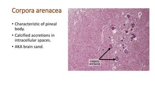 Corpora arenacea
• Characteristic of pineal
body.
• Calcified accretions in
intracellular spaces.
• AKA brain sand.
 