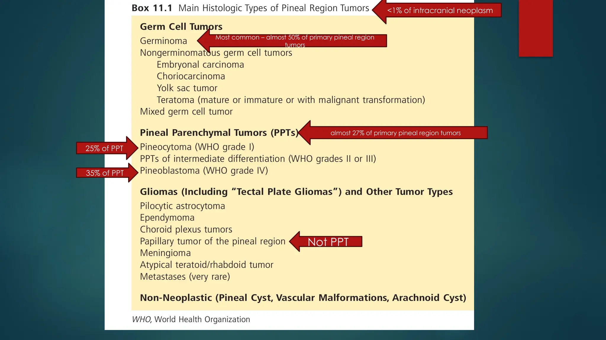 pineal gland tumors ( pineal gland )- approach | PPTX