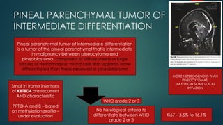 pineal gland tumors ( pineal gland )- approach | PPTX