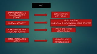 pineal gland tumors ( pineal gland )- approach | PPTX